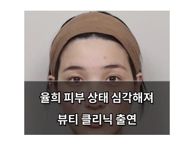 율희 피부 상태 심각해져 뷰티 클리닉 출연